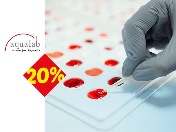 Ruka u rukavici testira uzorke krvi na beloj ploči, sa logom Aqualab i popustom od 20%.
