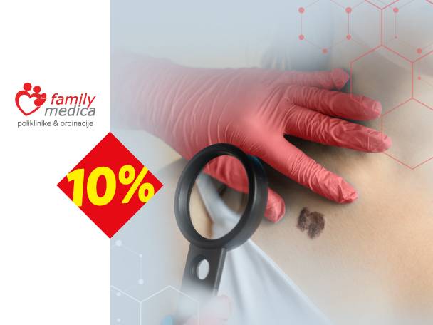 Ruka u rukavici drži lupu iznad mladeža na koži, sa logom Family Medica i 10% popusta.
