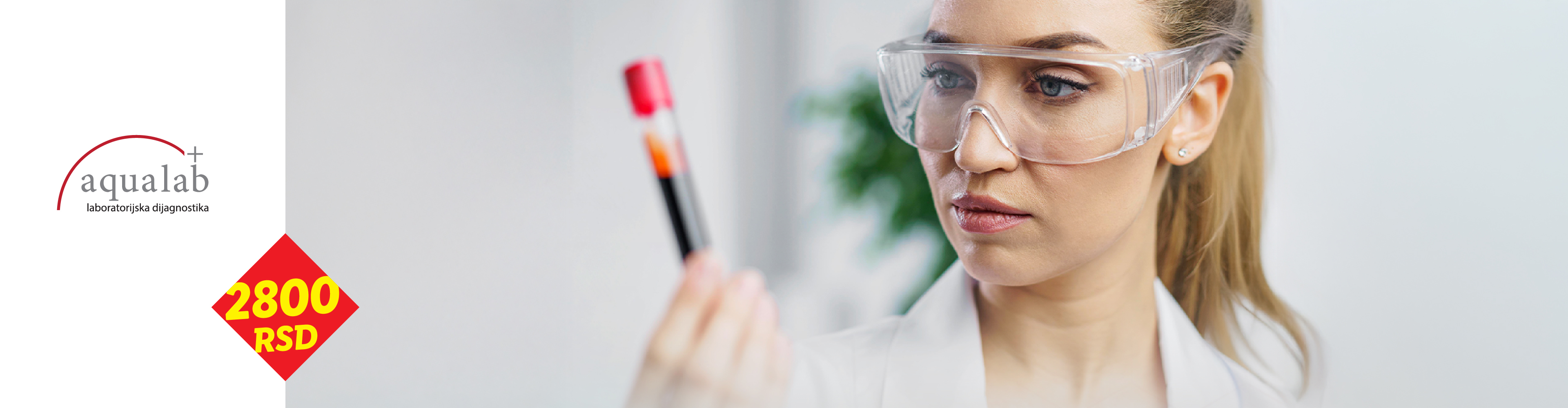 Žena u zaštitnim naočarima drži epruvetu sa krvlju, sa logotipom laboratorije i cenom od 2800 RSD.