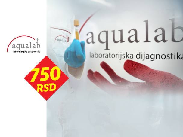 Laboratorijska dijagnostika sa epruvetom i cenom od 750 RSD.
