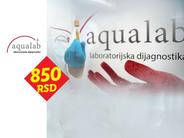 Laboratorijska dijagnostika sa epruvetom i cenom od 850 RSD.